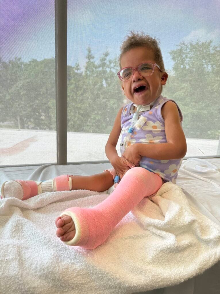 A young child with glasses and a pink cast smiles